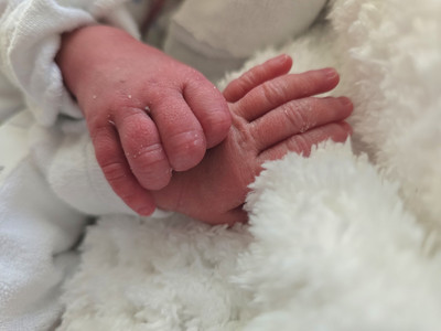 Das Zwillingpaar Cetin war für das Geburtshilfe-Team ebenfalls eine besondere Erfahrung.